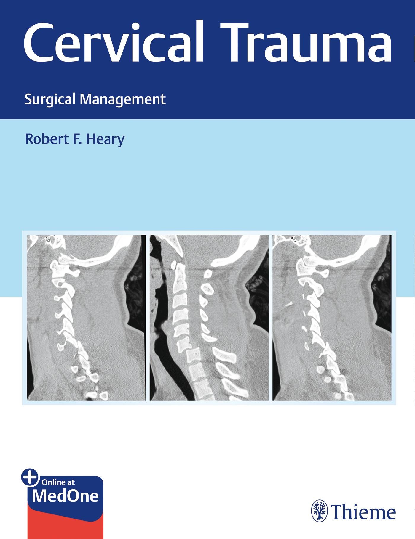 Vorderes Coverbild Cervical Trauma