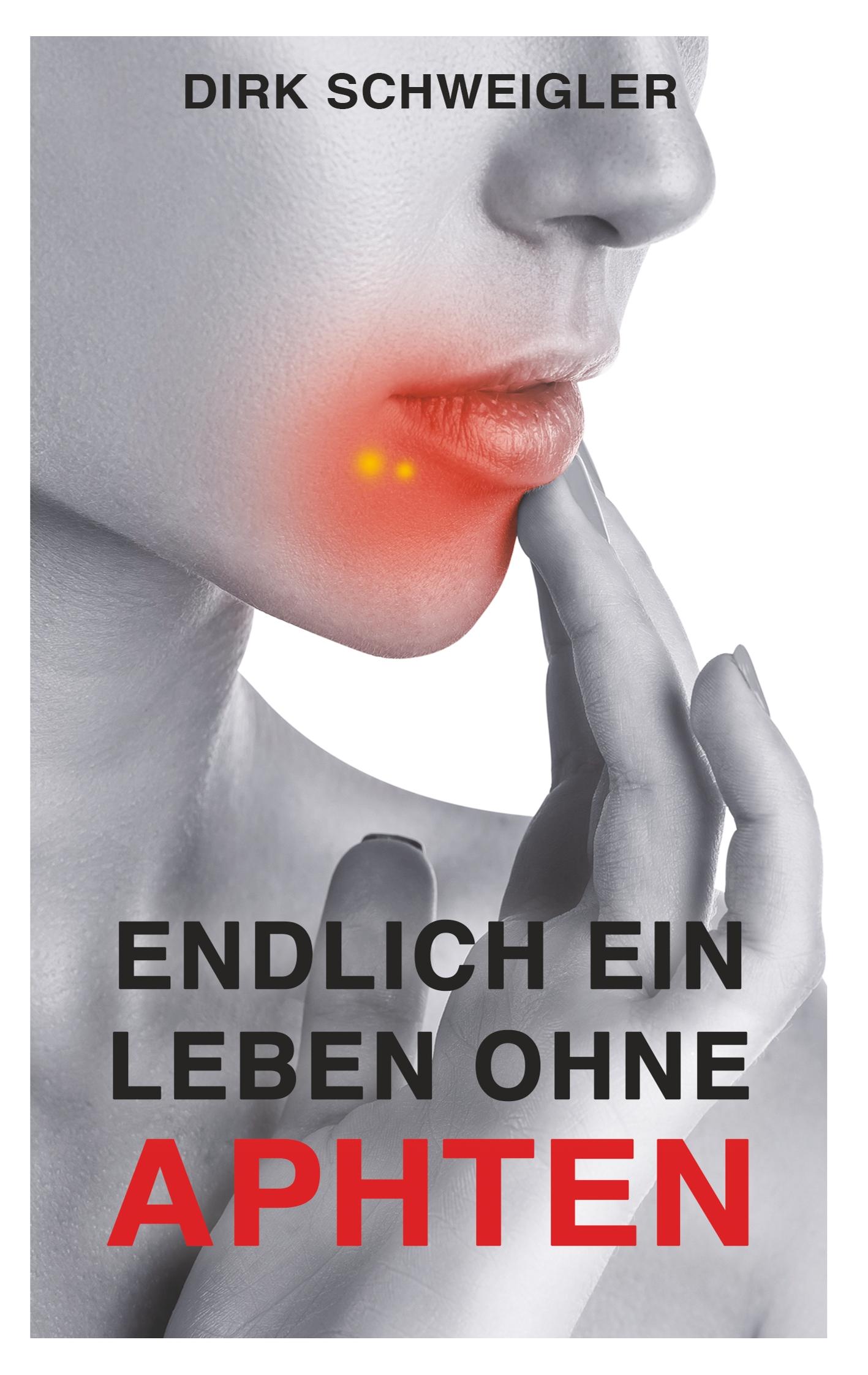 Vorderes Coverbild Endlich ein Leben ohne Aphten