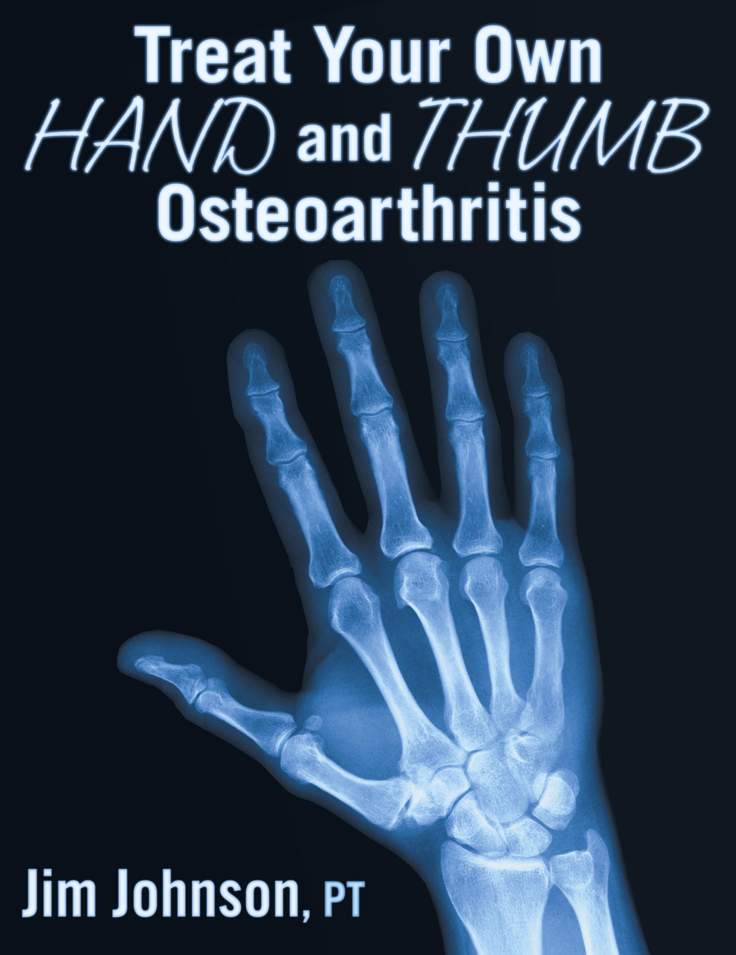 Vorderes Coverbild Treat Your Own Hand and Thumb Osteoarthritis