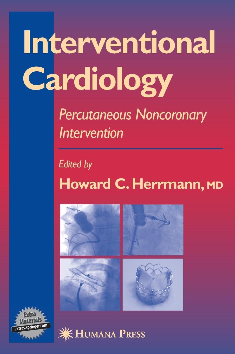 Vorderes Coverbild Interventional Cardiology