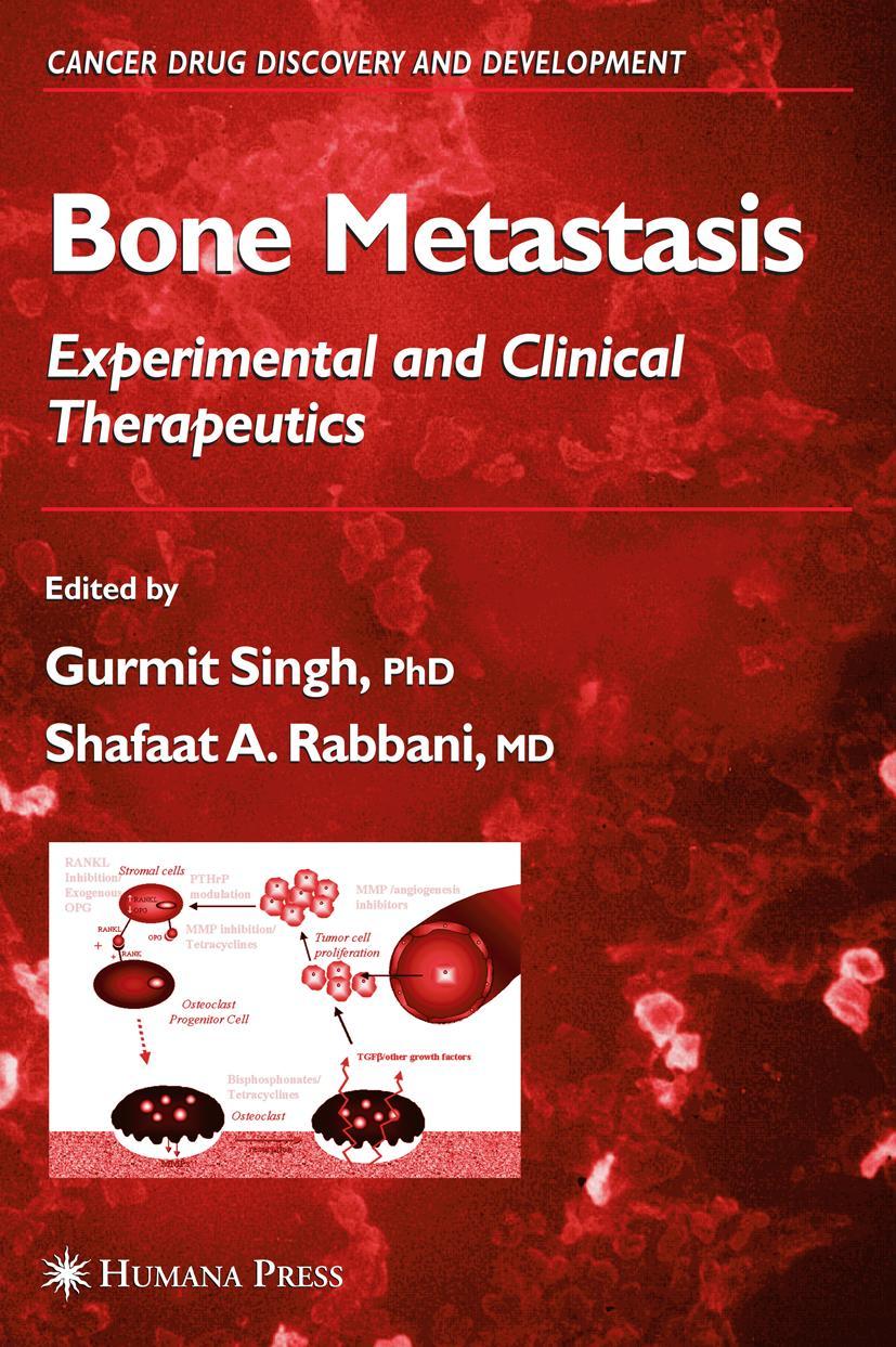 Vorderes Coverbild Bone Metastasis