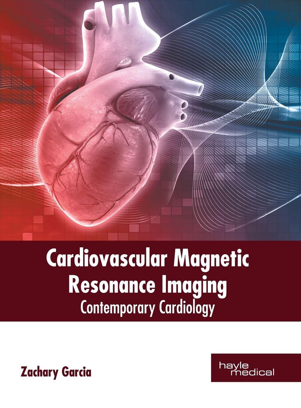 Vorderes Coverbild Cardiovascular Magnetic Resonance Imaging