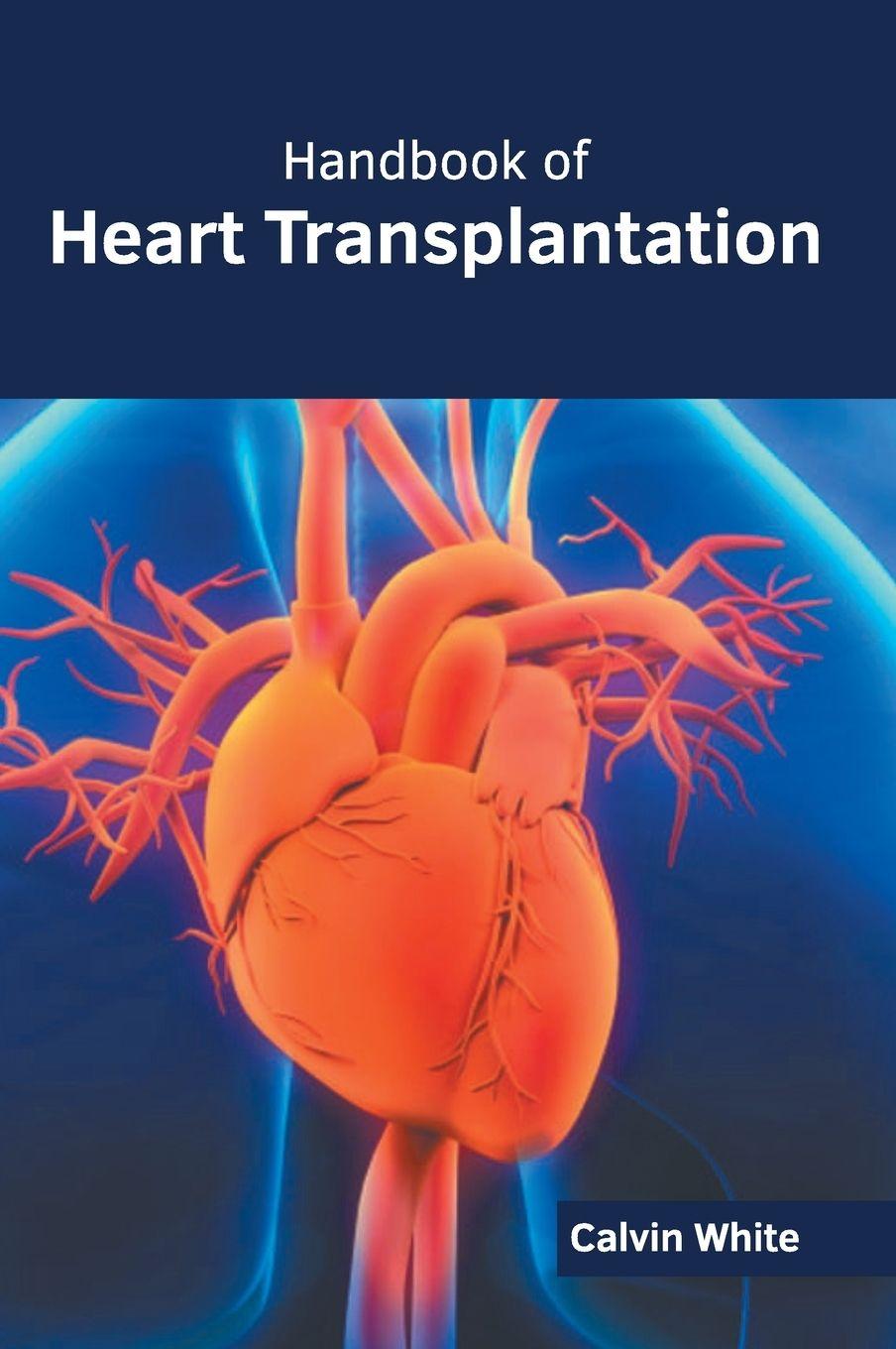 Vorderes Coverbild Handbook of Heart Transplantation