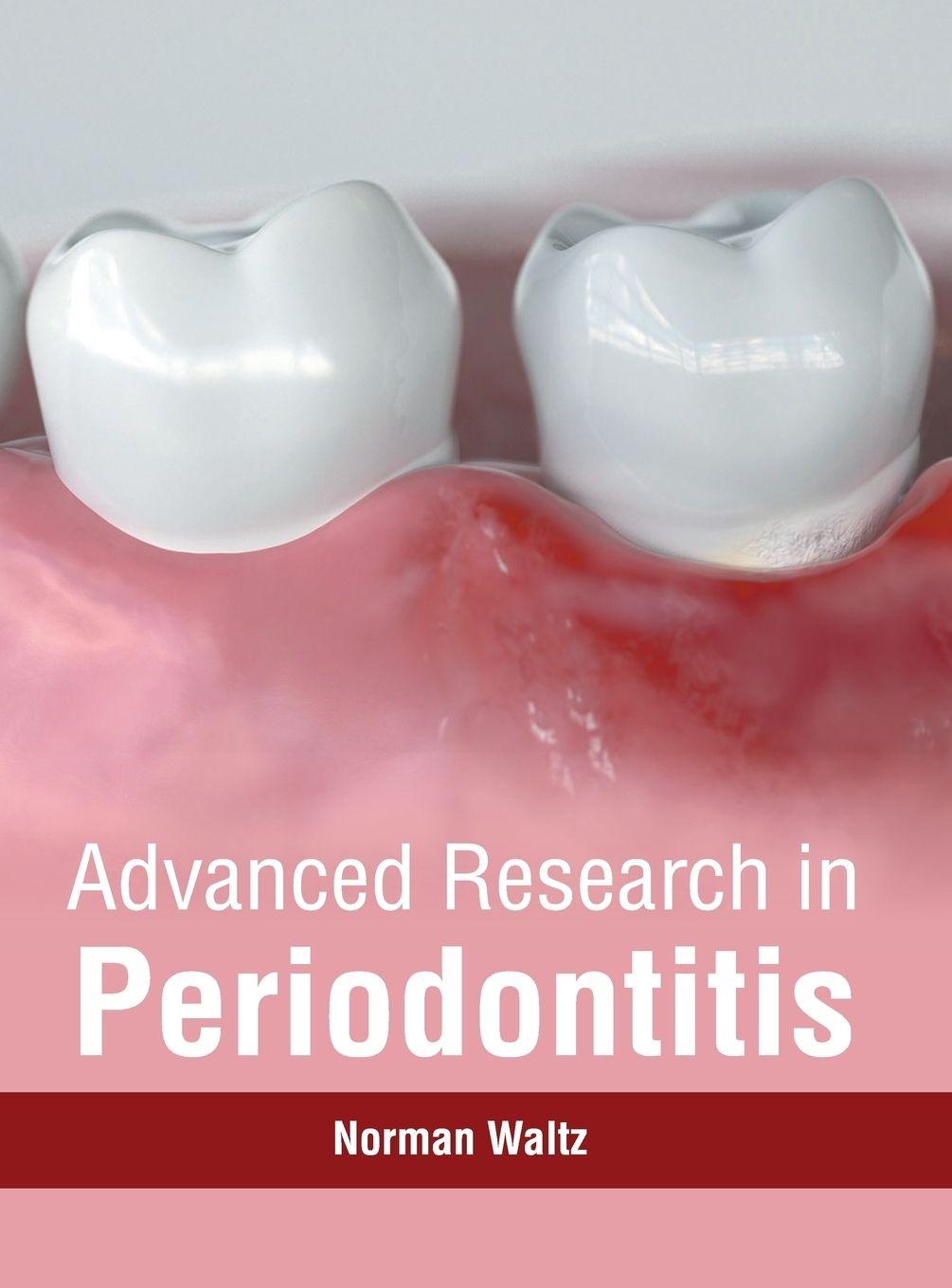Vorderes Coverbild Advanced Research in Periodontitis