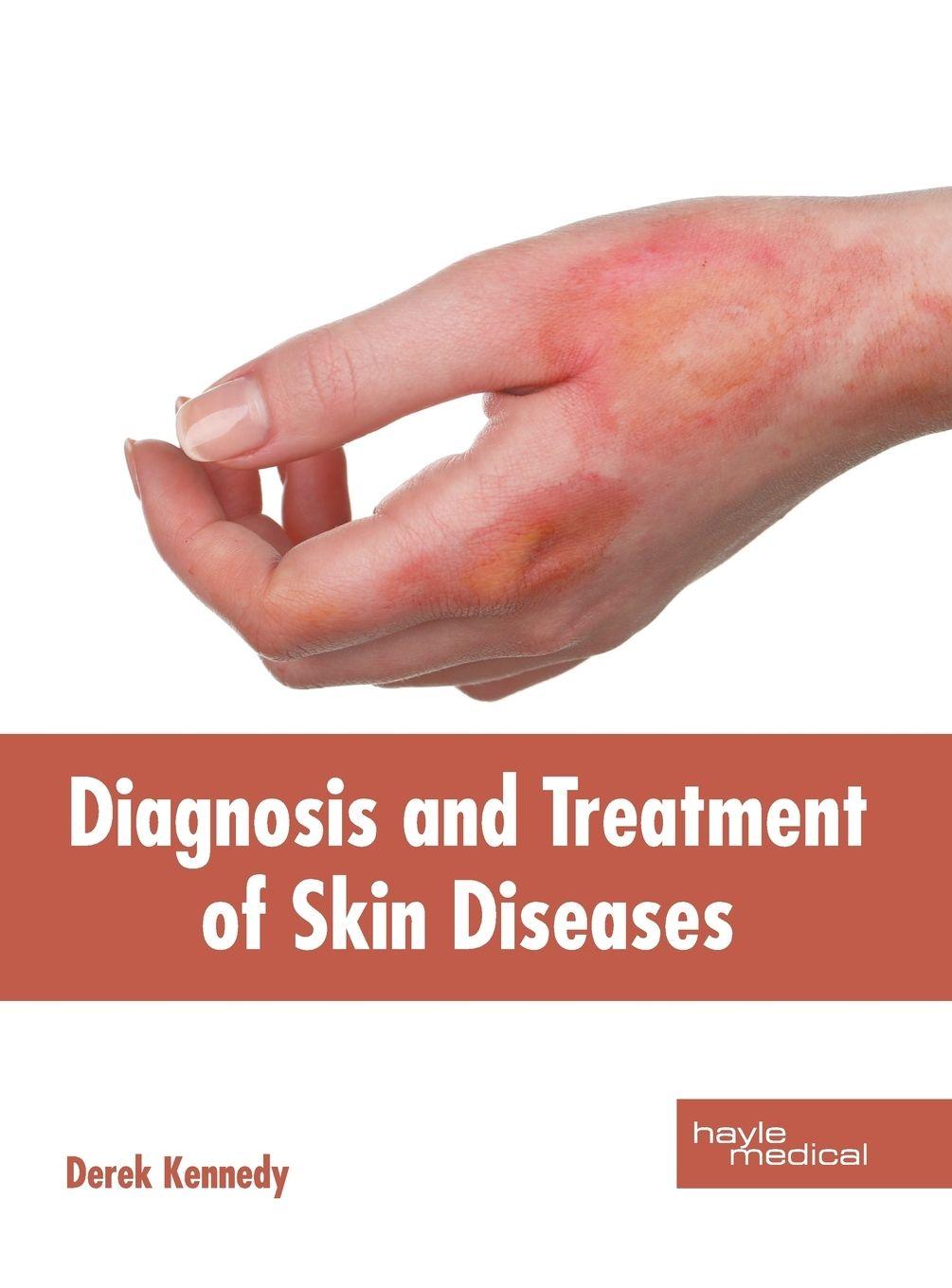 Vorderes Coverbild Diagnosis and Treatment of Skin Diseases
