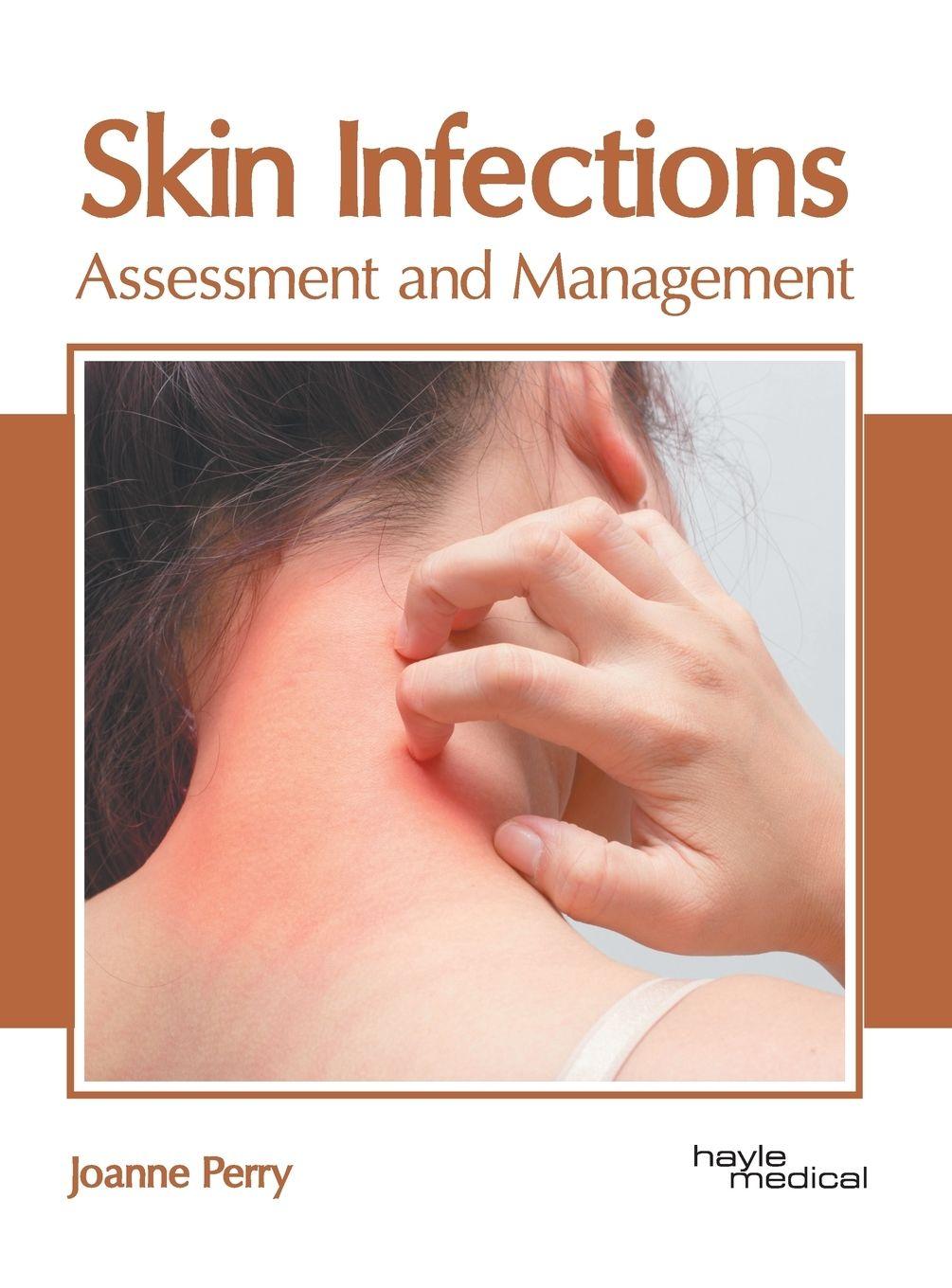 Vorderes Coverbild Skin Infections: Assessment and Management