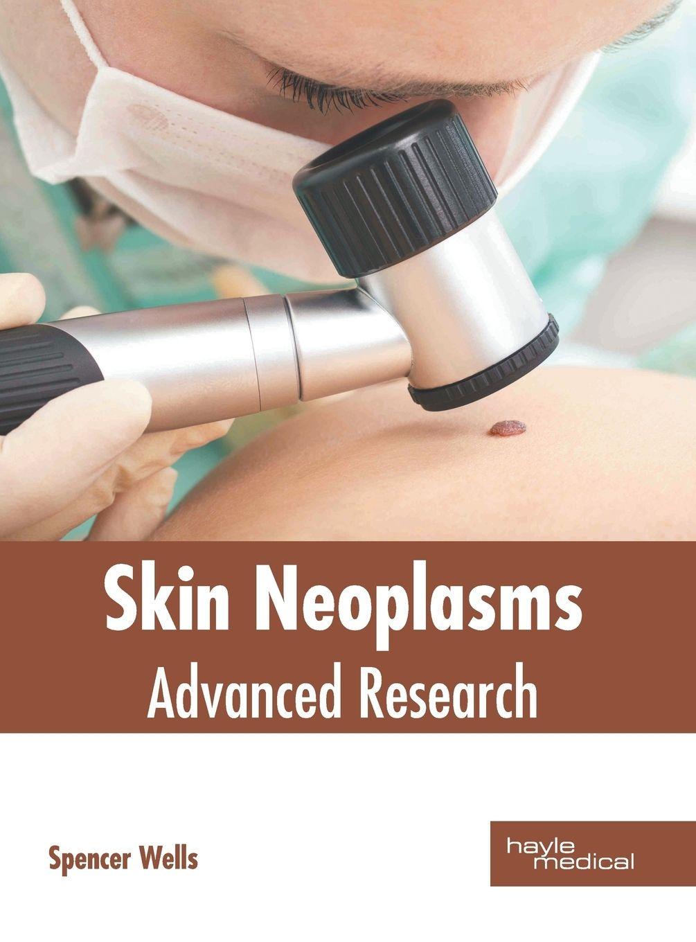 Vorderes Coverbild Skin Neoplasms: Advanced Research