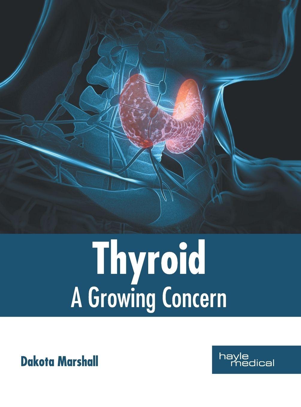 Vorderes Coverbild Thyroid
