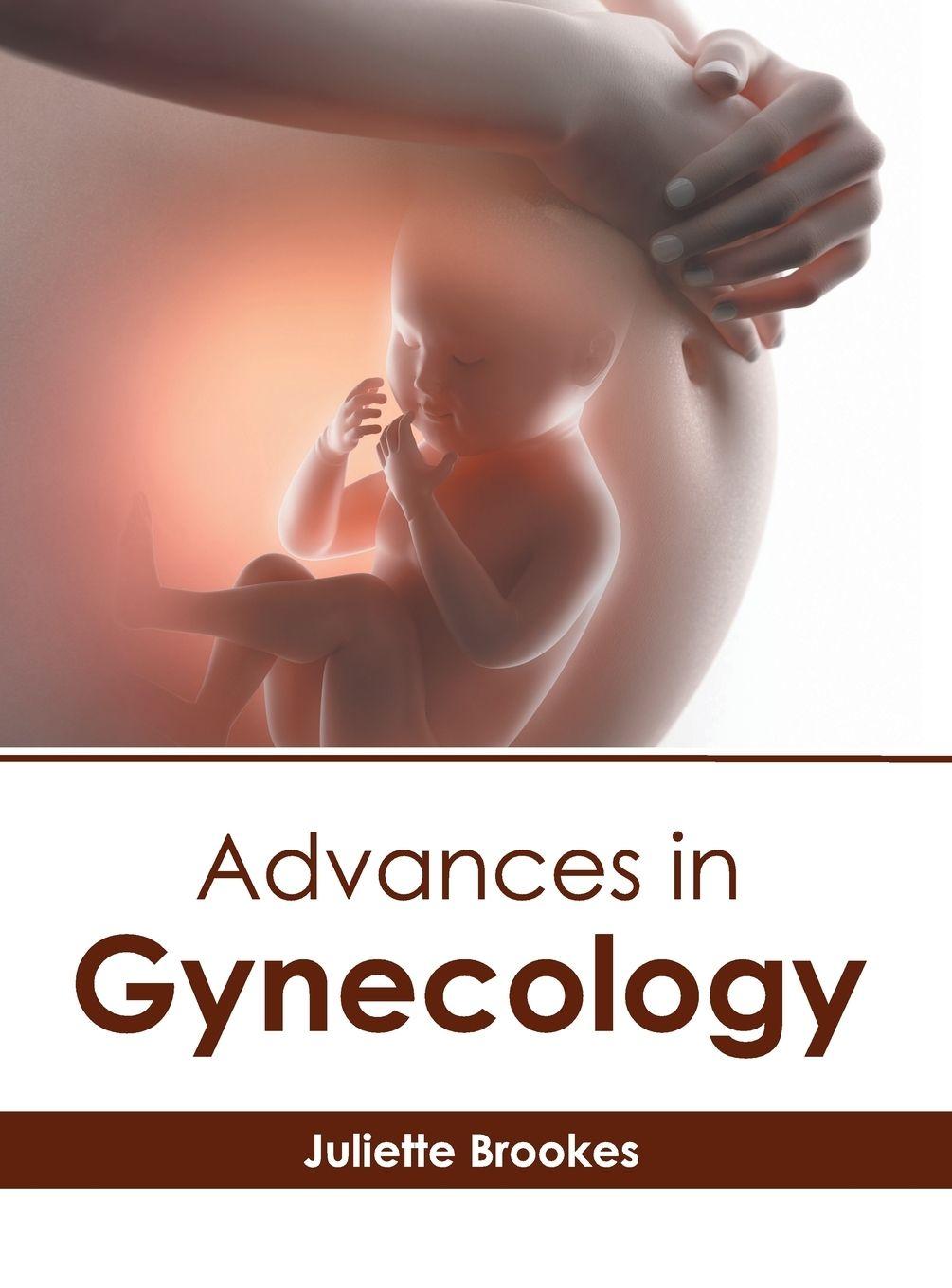 Vorderes Coverbild Advances in Gynecology