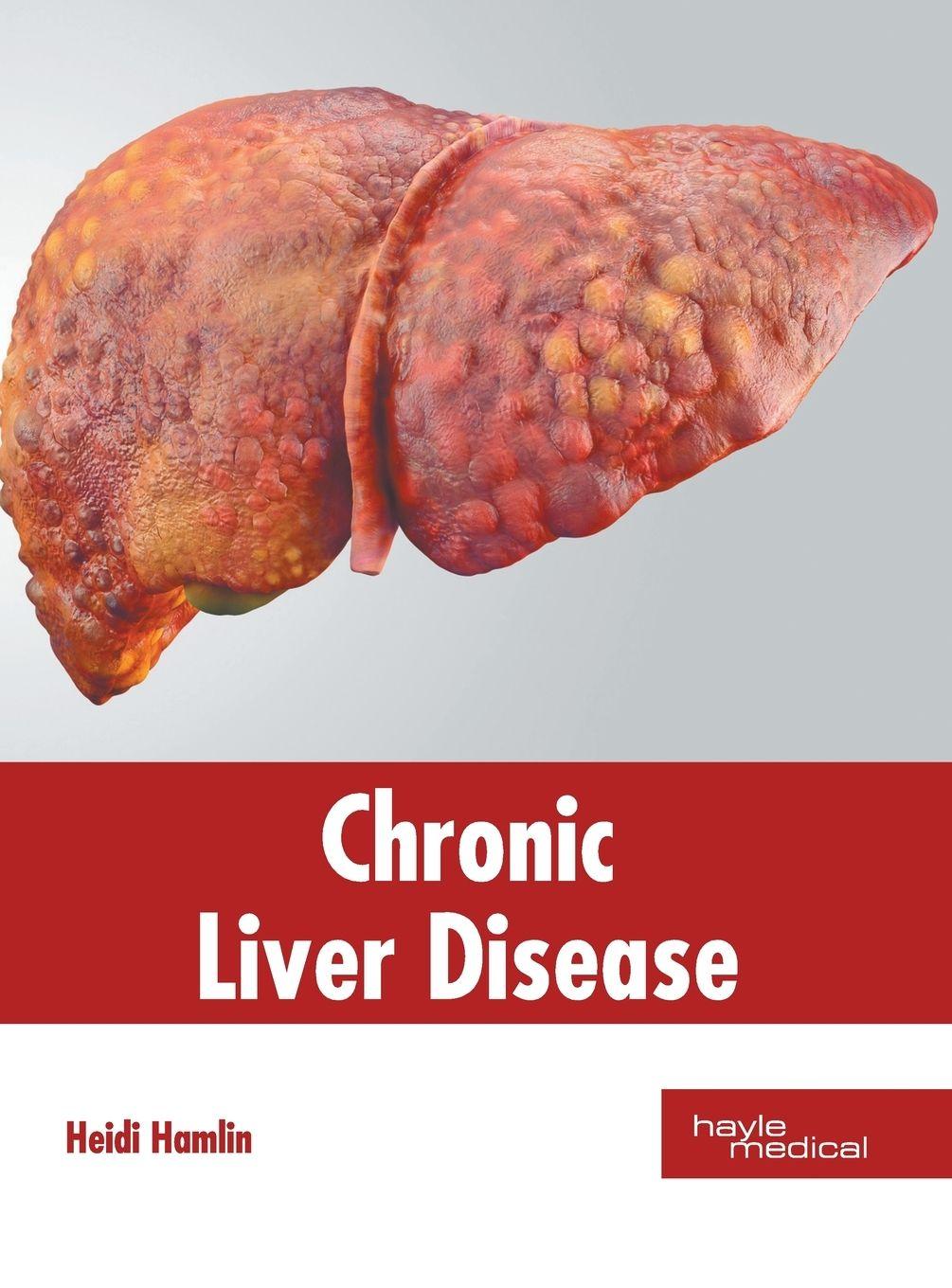 Vorderes Coverbild Chronic Liver Disease