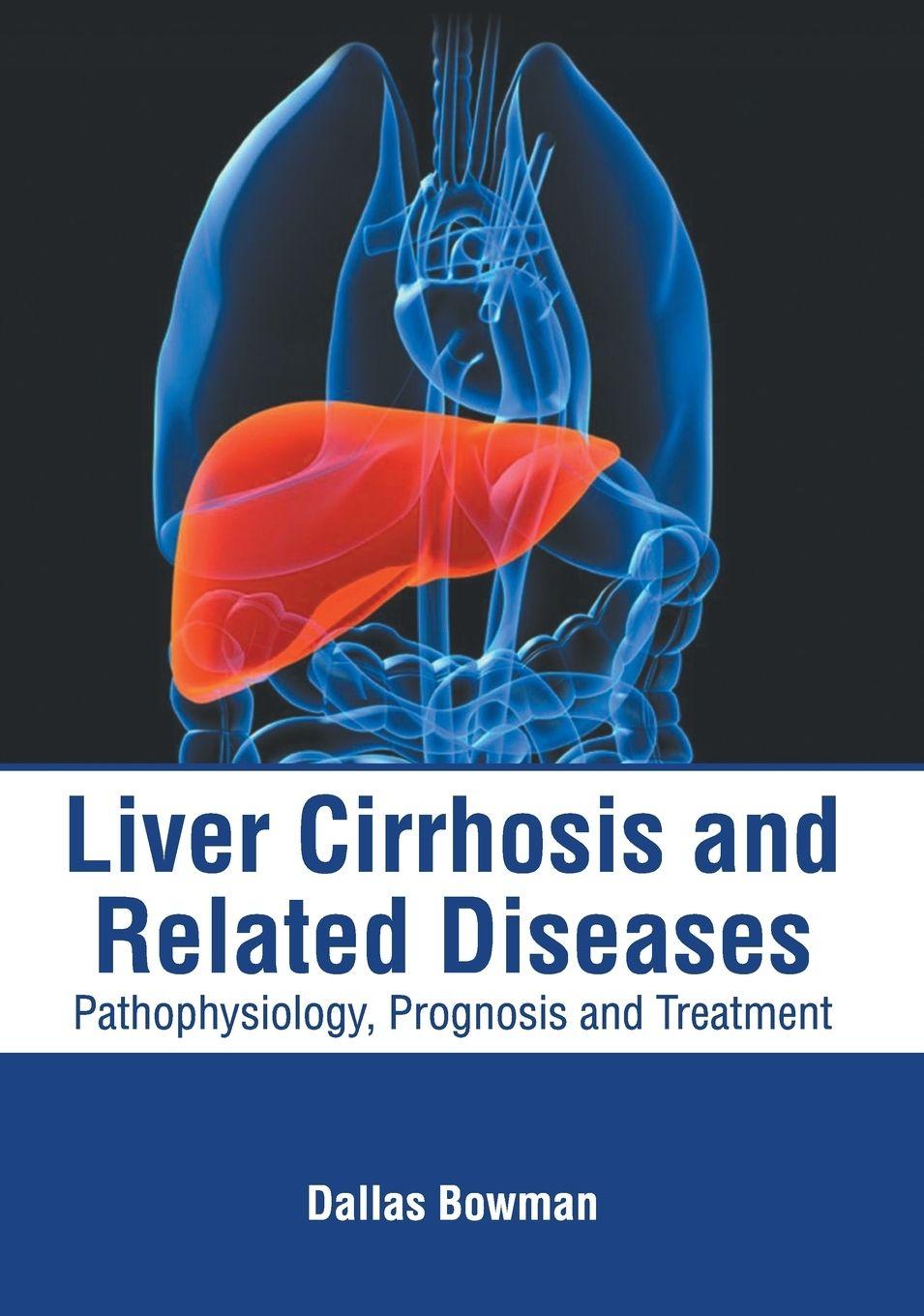 Vorderes Coverbild Liver Cirrhosis and Related Diseases