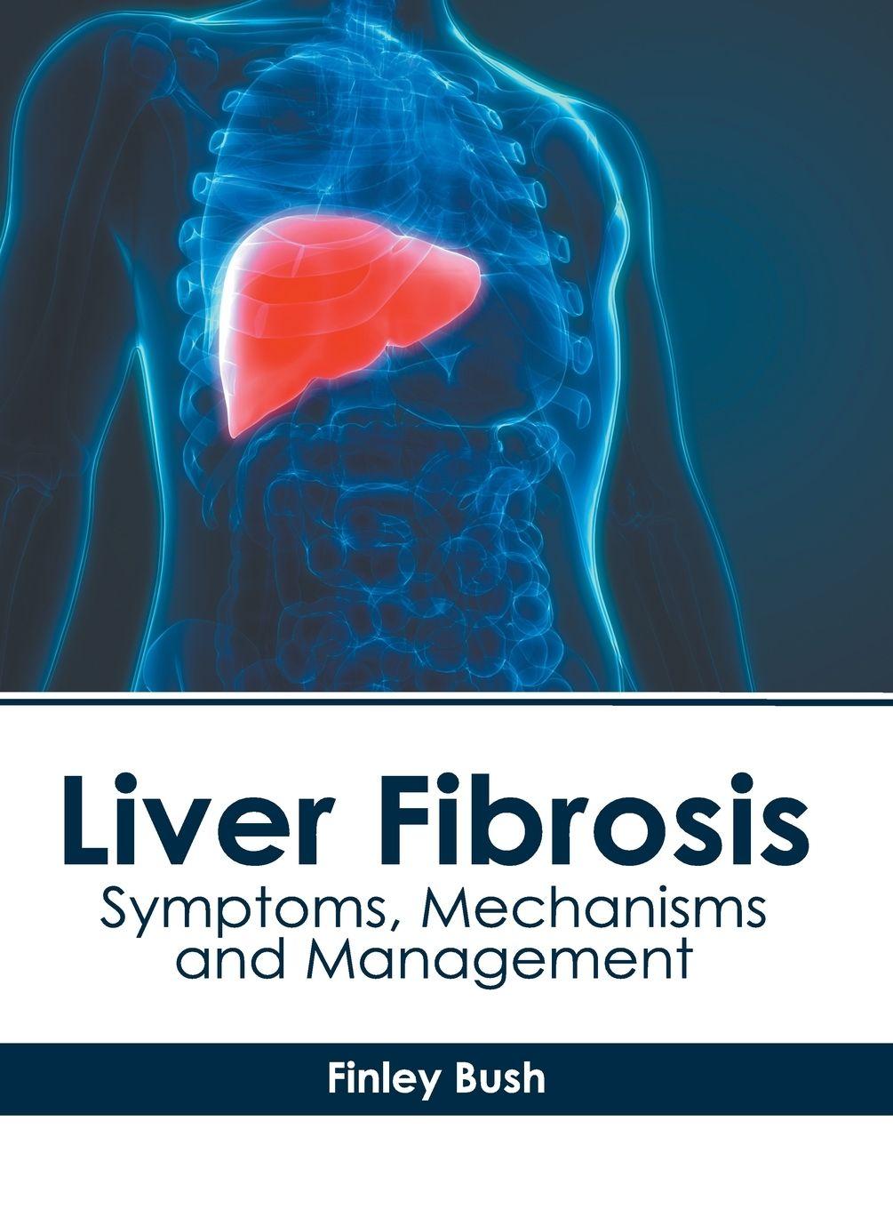 Vorderes Coverbild Liver Fibrosis