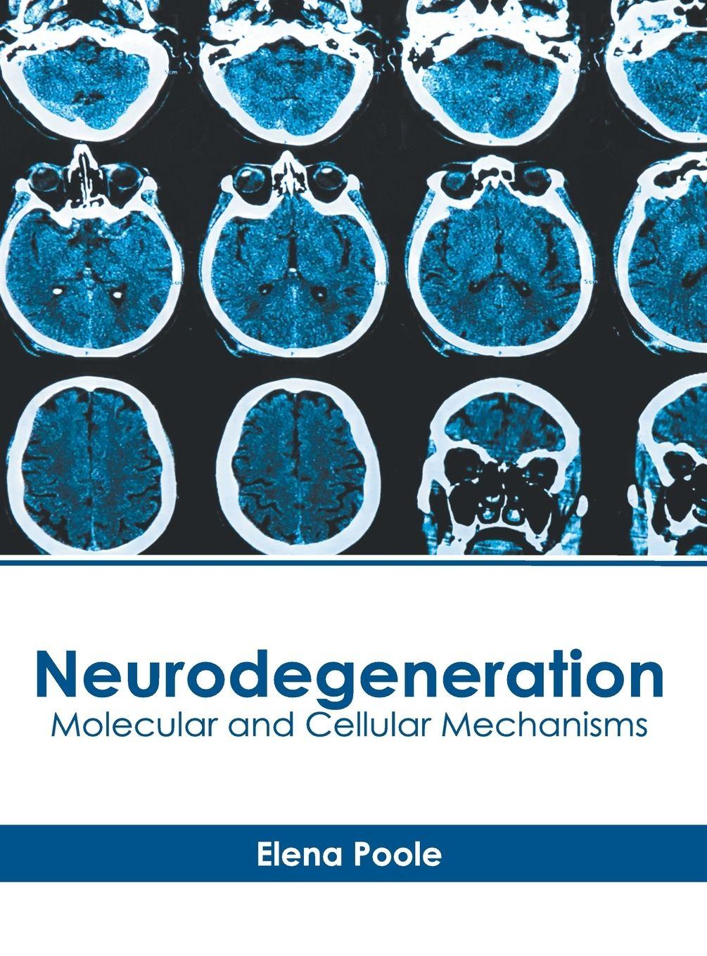 Vorderes Coverbild Neurodegeneration