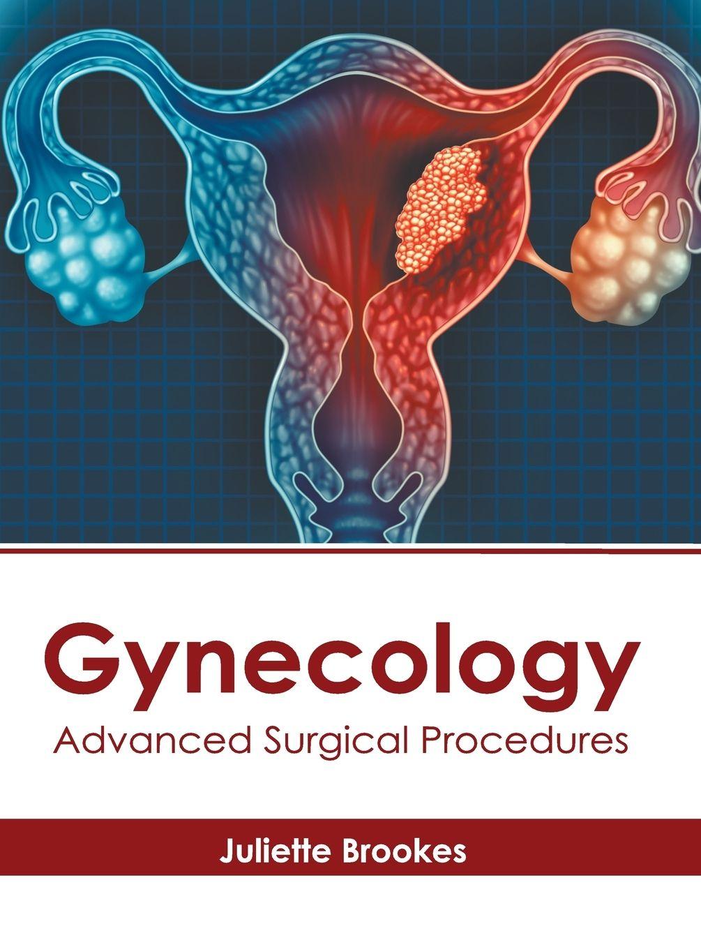 Vorderes Coverbild Gynecology