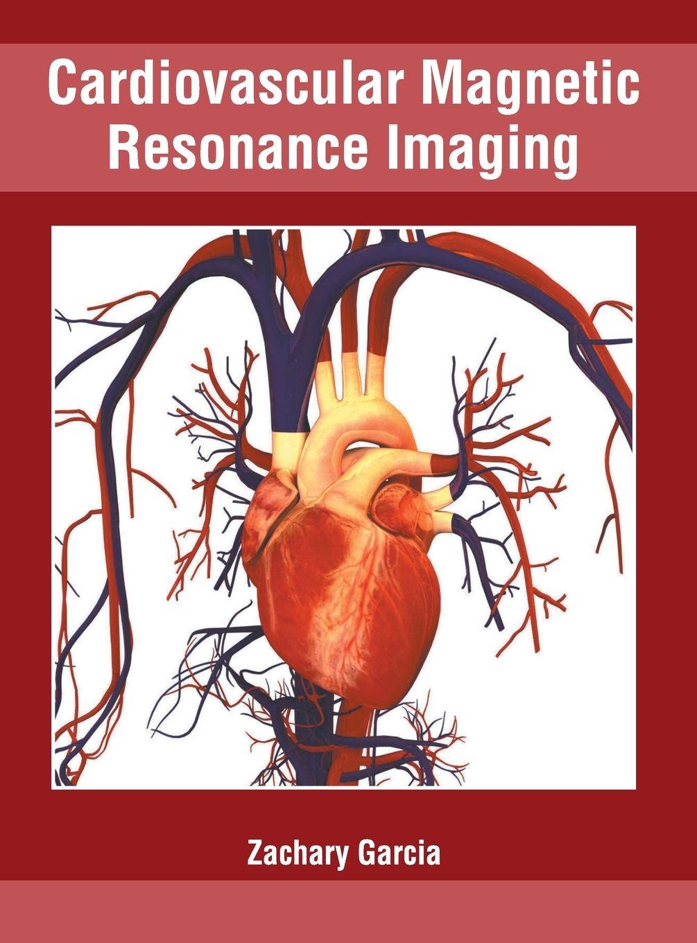Vorderes Coverbild Cardiovascular Magnetic Resonance Imaging