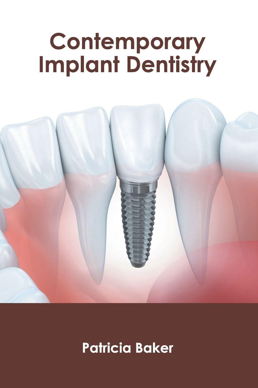 Vorderes Coverbild Contemporary Implant Dentistry
