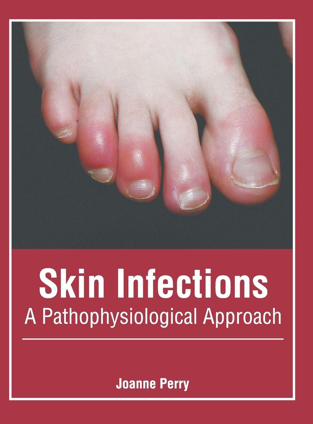 Vorderes Coverbild Skin Infections: A Pathophysiological Approach