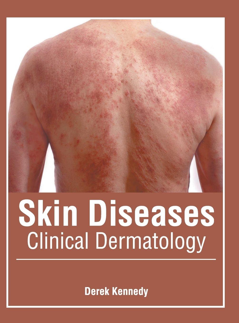 Vorderes Coverbild Skin Diseases: Clinical Dermatology