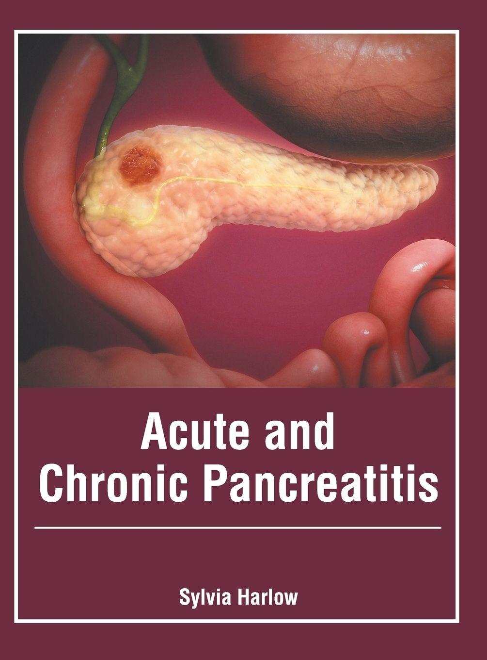 Vorderes Coverbild Acute and Chronic Pancreatitis