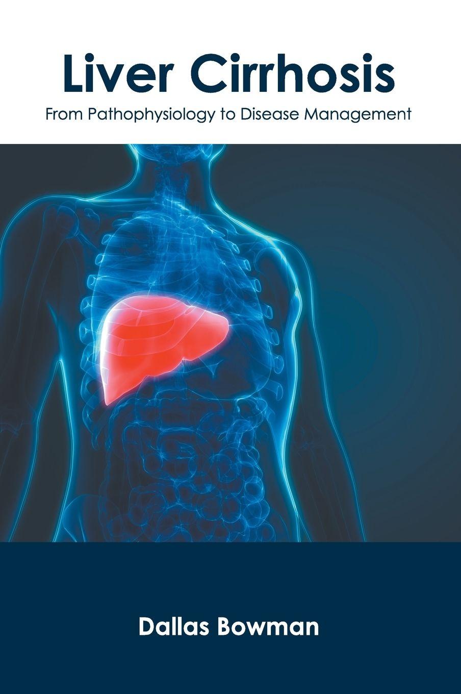 Vorderes Coverbild Liver Cirrhosis: From Pathophysiology to Disease Management