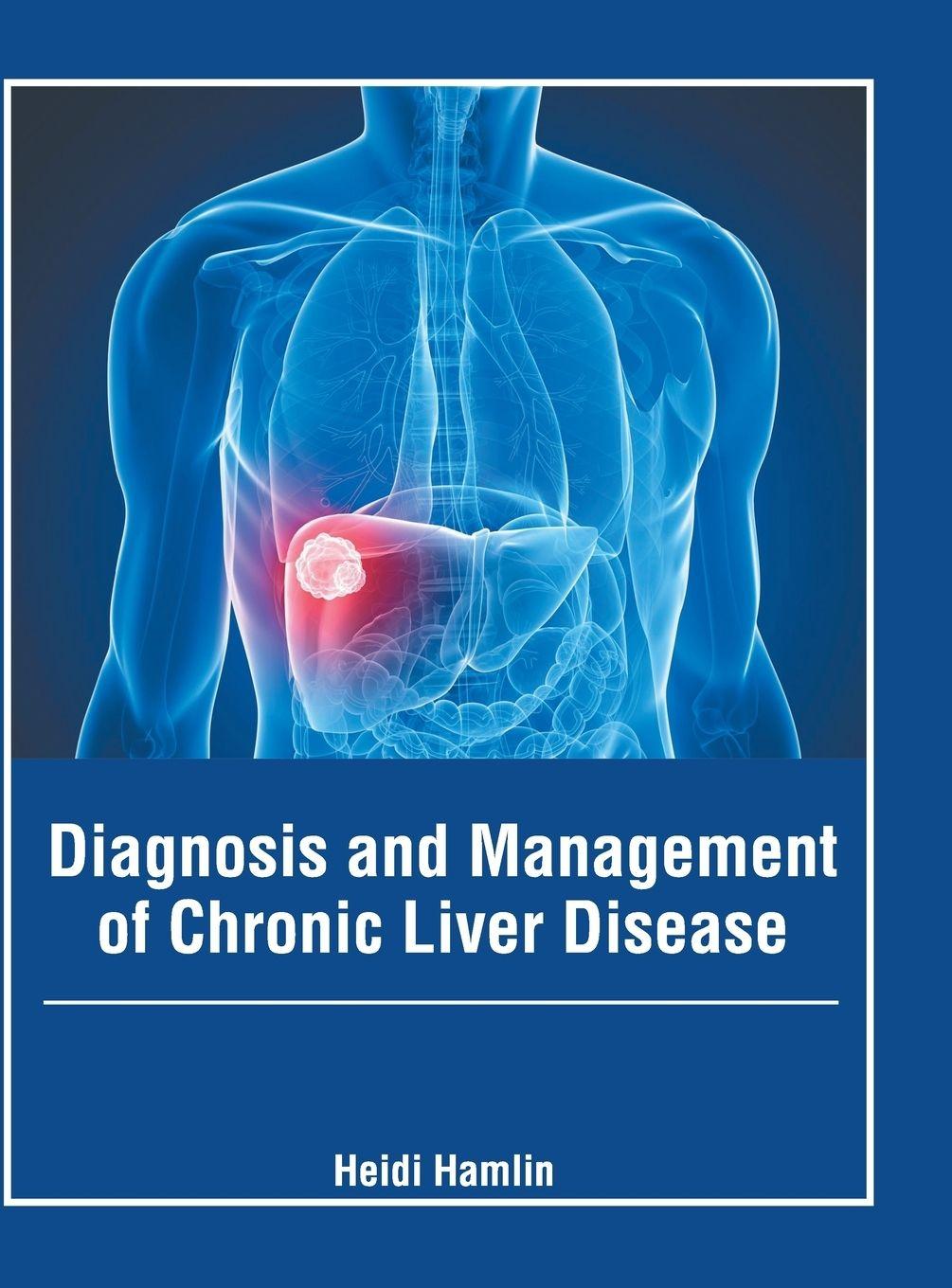 Vorderes Coverbild Diagnosis and Management of Chronic Liver Disease