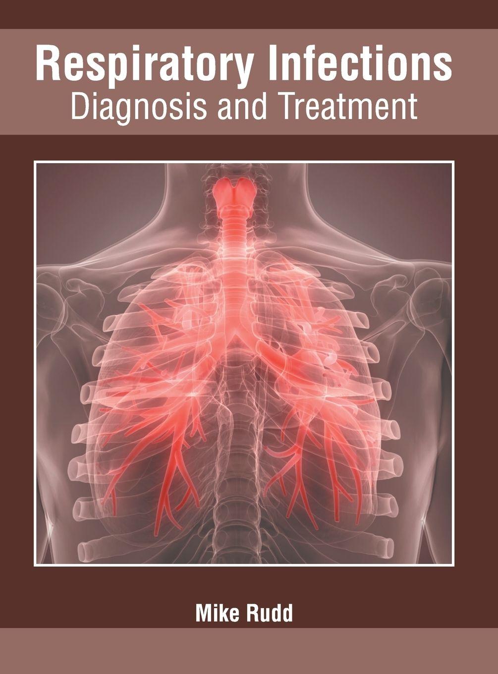 Vorderes Coverbild Respiratory Infections: Diagnosis and Treatment