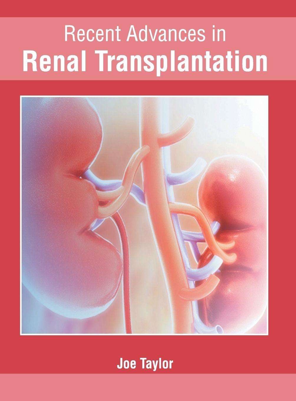 Vorderes Coverbild Recent Advances in Renal Transplantation