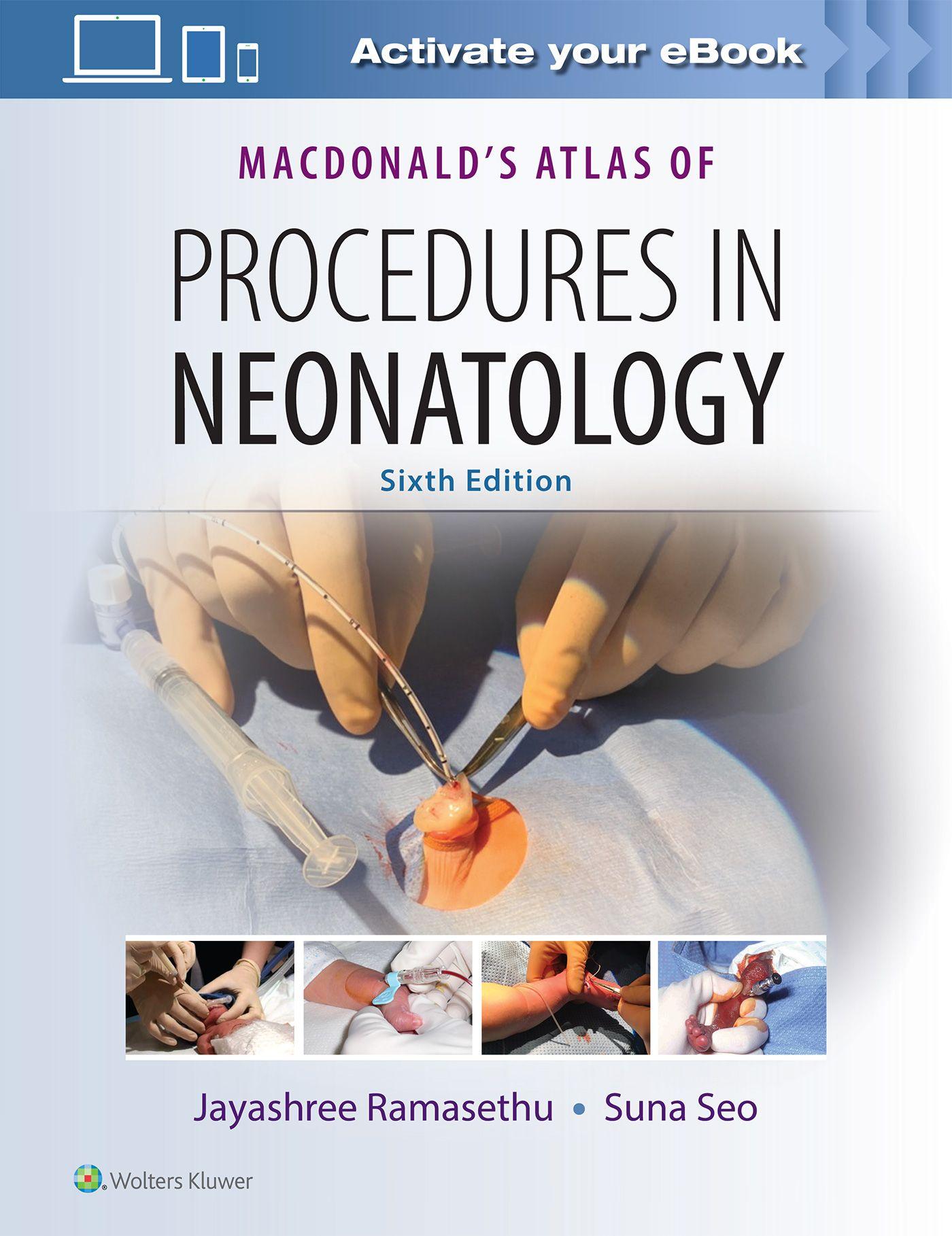 Vorderes Coverbild MacDonald's Atlas of Procedures in Neonatology