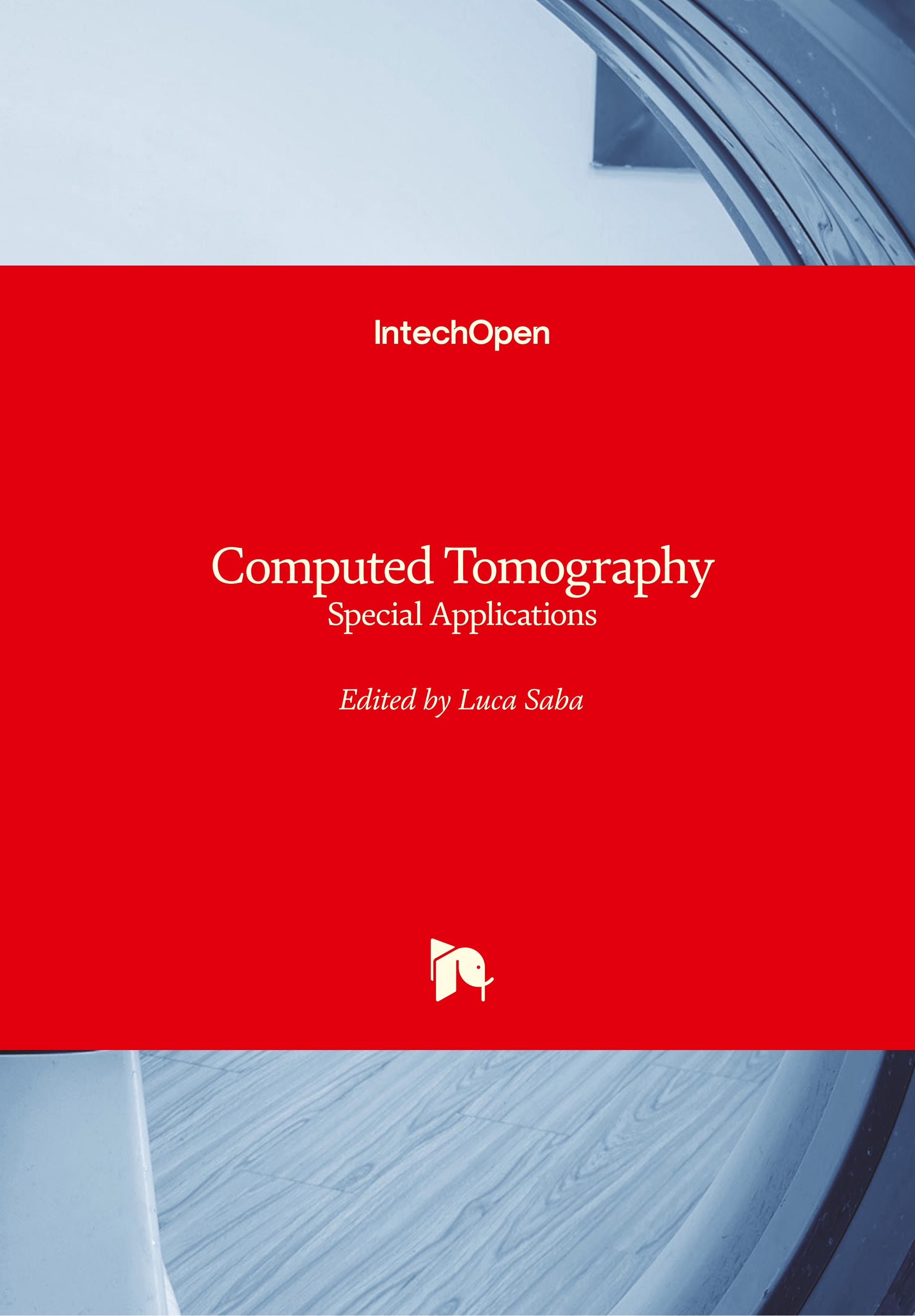 Vorderes Coverbild Computed Tomography