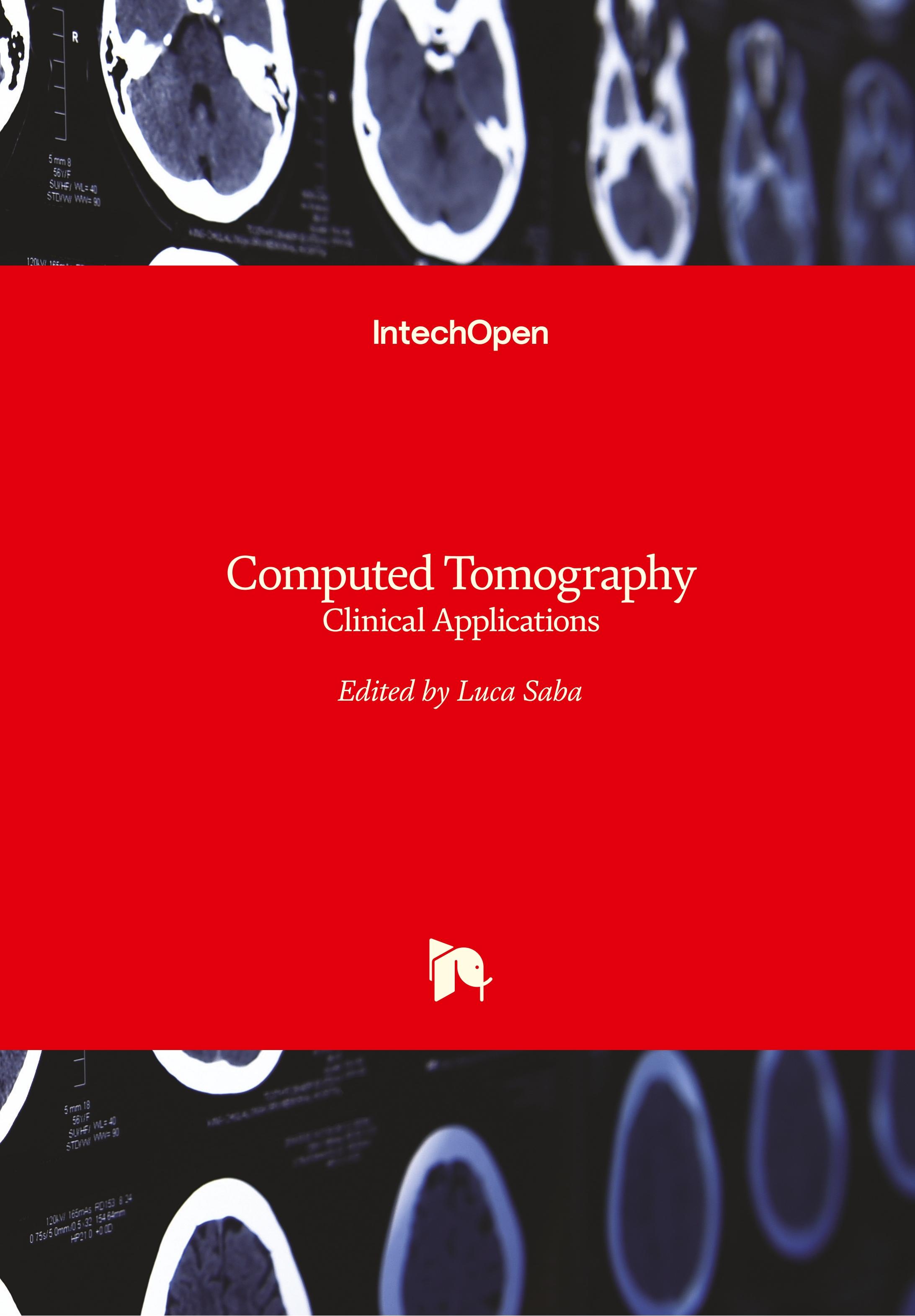 Vorderes Coverbild Computed Tomography