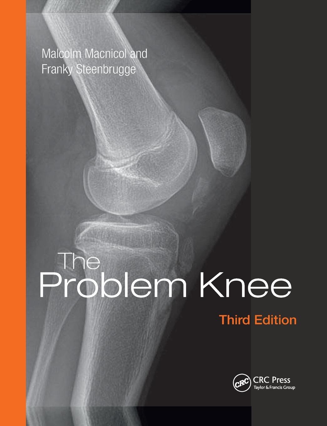 Vorderes Coverbild The Problem Knee