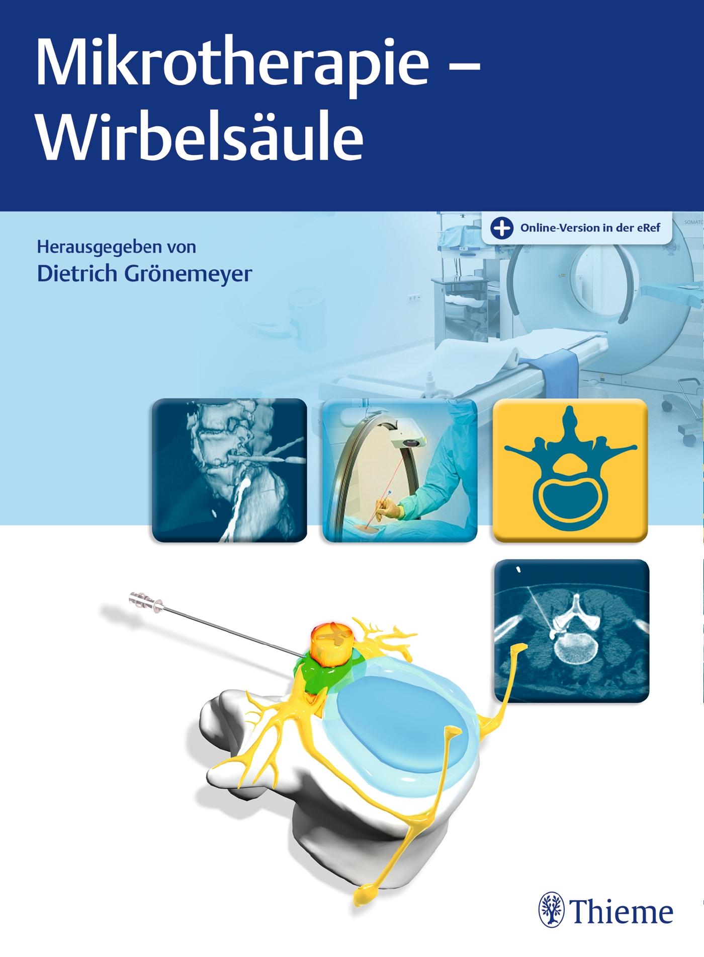 Vorderes Coverbild Mikrotherapie - Wirbelsäule