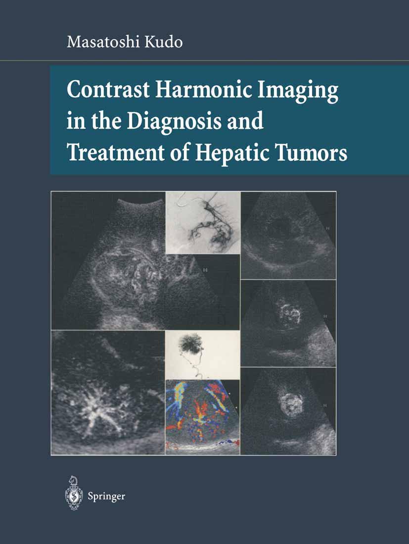 Vorderes Coverbild Contrast Harmonic Imaging in the Diagnosis and Treatment of Hepatic Tumors