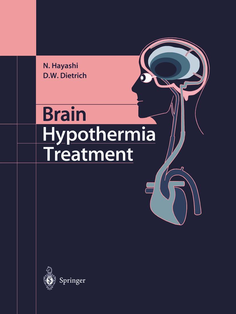 Vorderes Coverbild Brain Hypothermia Treatment