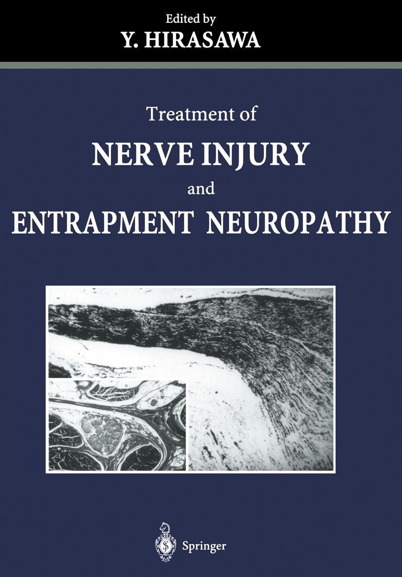 Vorderes Coverbild Treatment of Nerve Injury and Entrapment Neuropathy