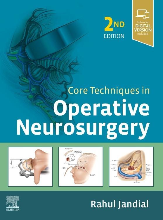 Vorderes Coverbild Core Techniques in Operative Neurosurgery