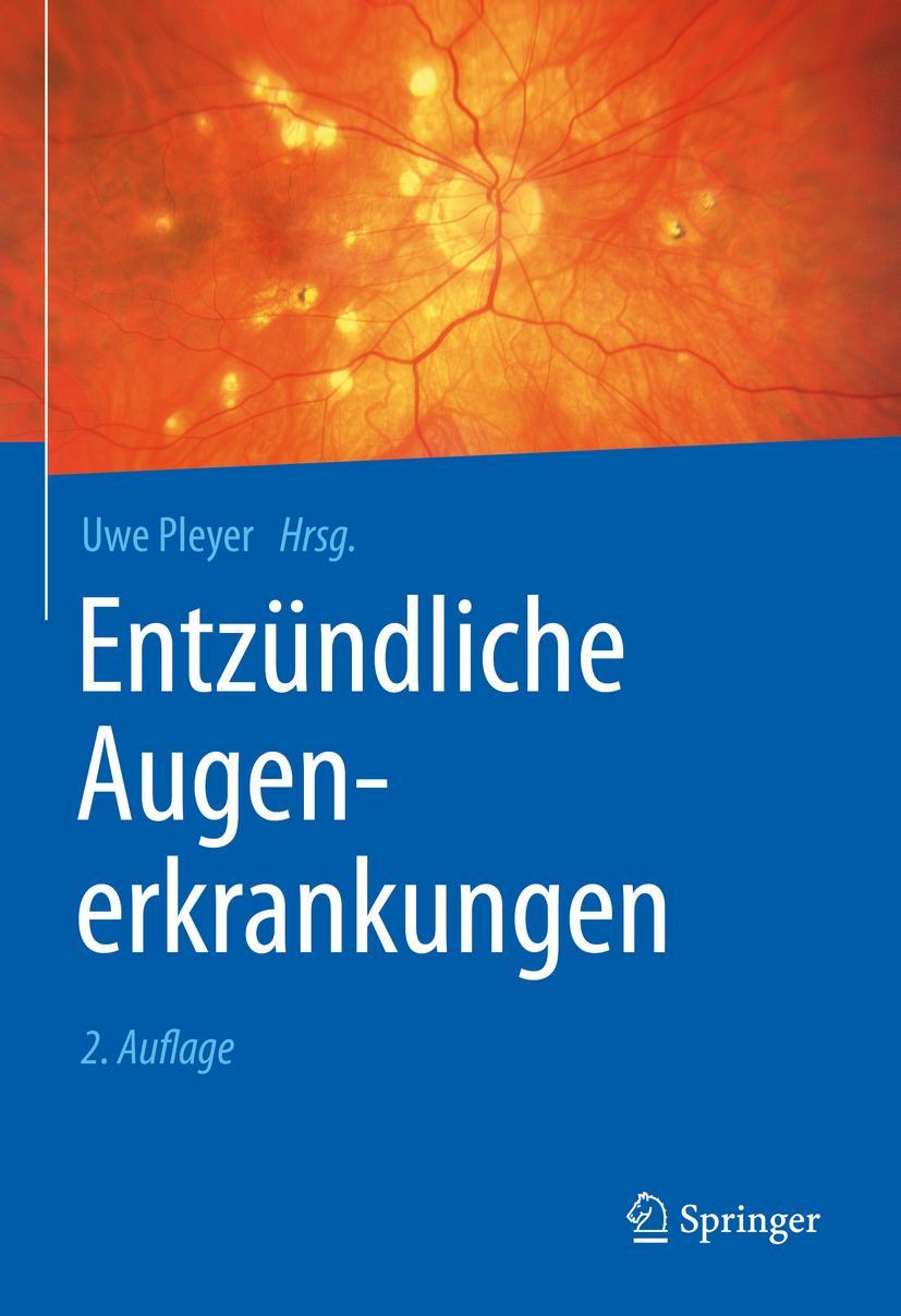 Vorderes Coverbild Entzündliche Augenerkrankungen