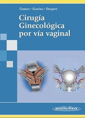 Vorderes Coverbild Cirugía ginecológica por vía vaginal