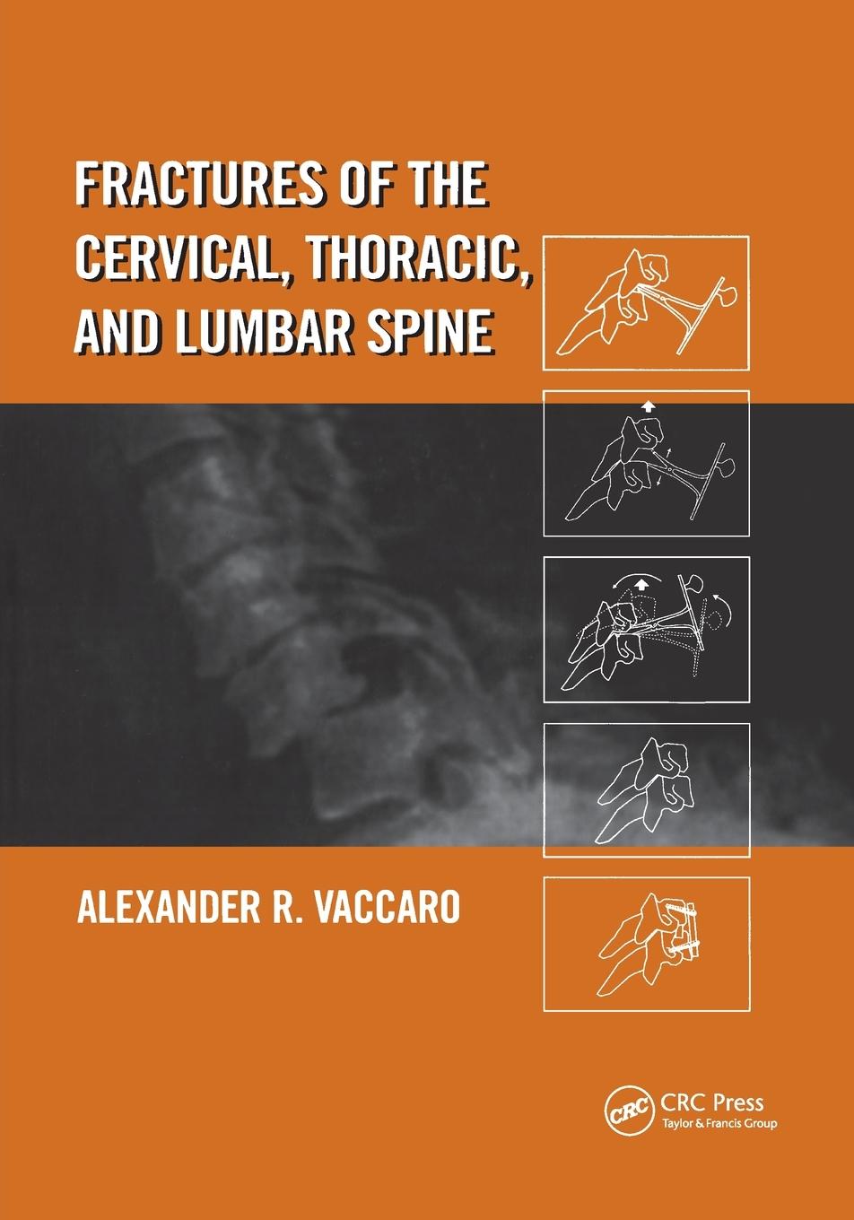 Vorderes Coverbild Fractures of the Cervical, Thoracic, and Lumbar Spine