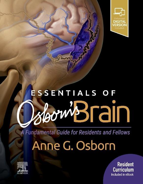 Vorderes Coverbild Essentials of Osborn's Brain