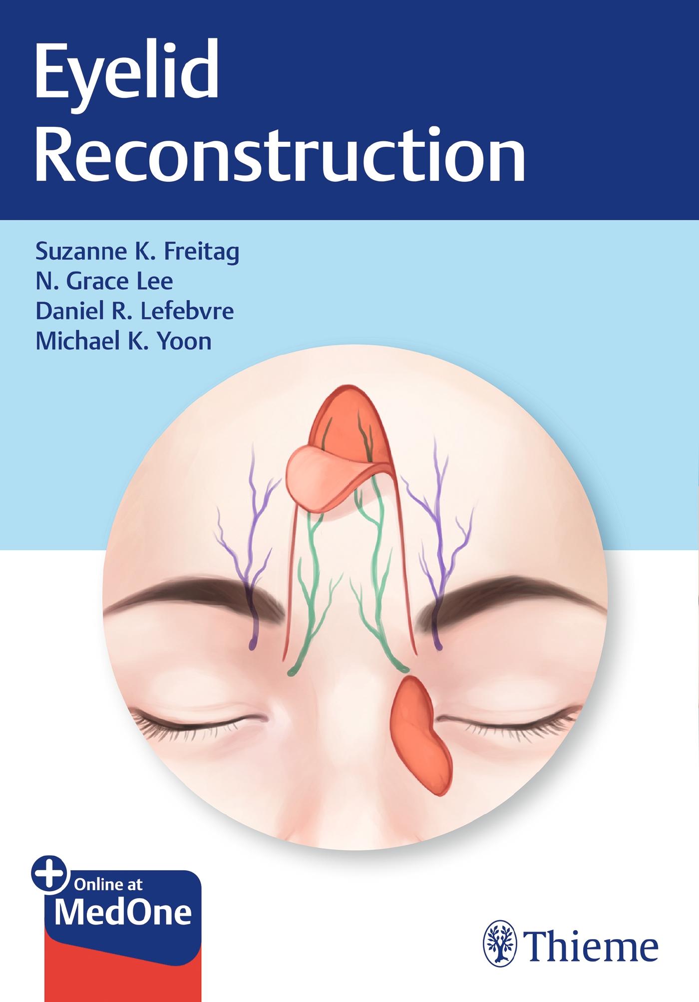 Vorderes Coverbild Eyelid Reconstruction