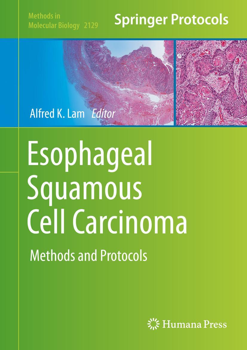 Vorderes Coverbild Esophageal Squamous Cell Carcinoma