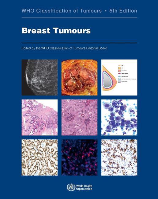 Vorderes Coverbild Breast Tumours