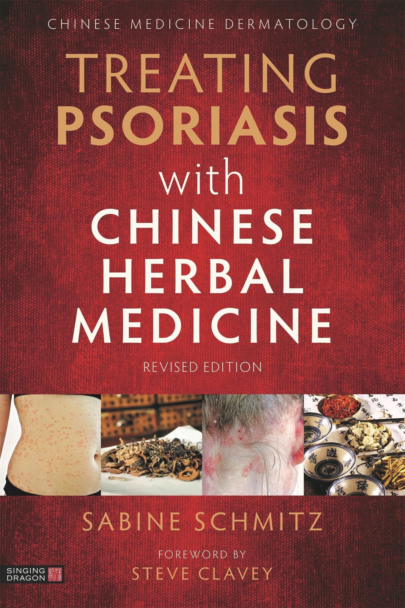 Vorderes Coverbild Treating Psoriasis with Chinese Herbal Medicine (Revised Edition)
