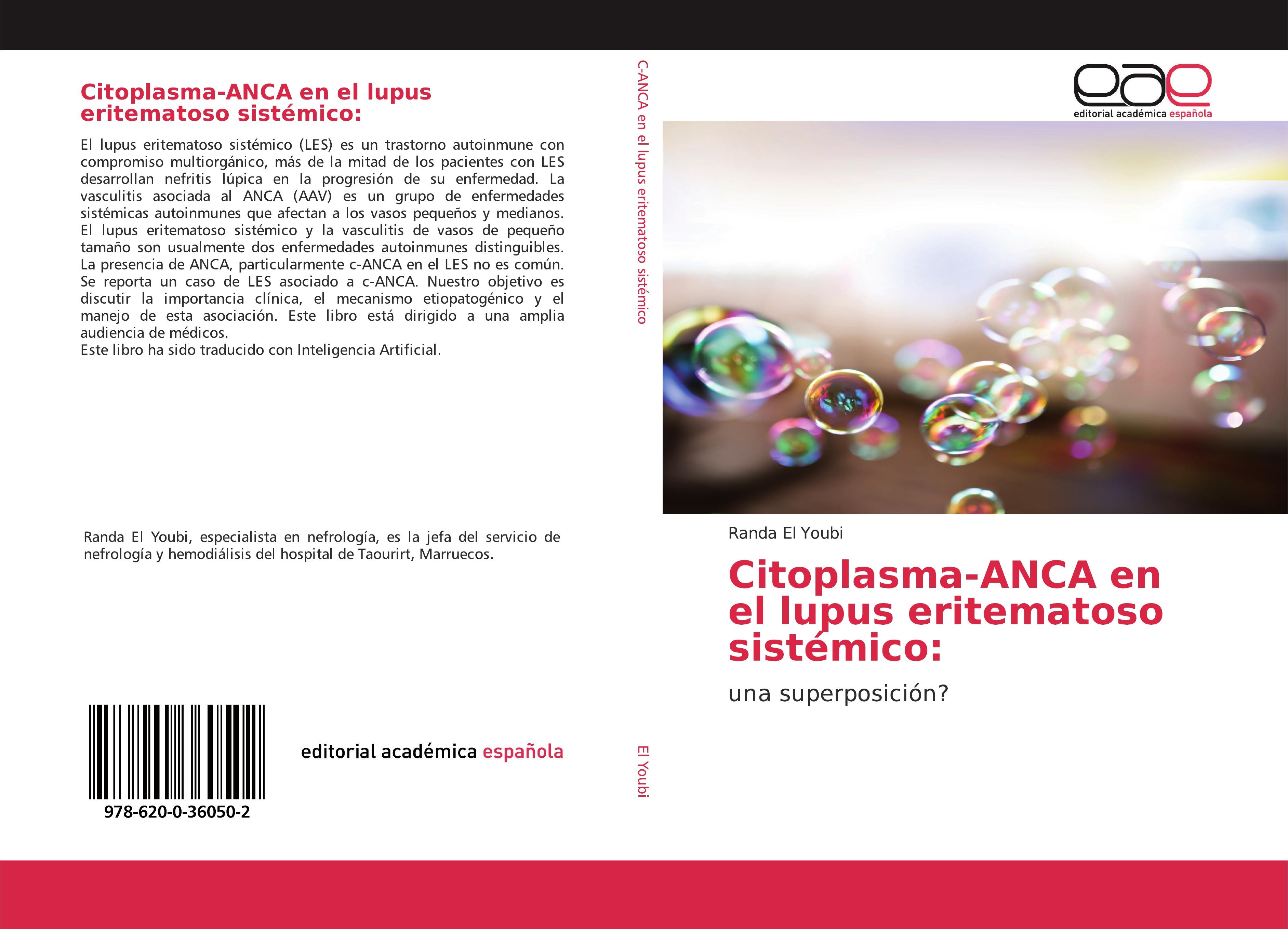 Vorderes Coverbild Citoplasma-ANCA en el lupus eritematoso sistémico: