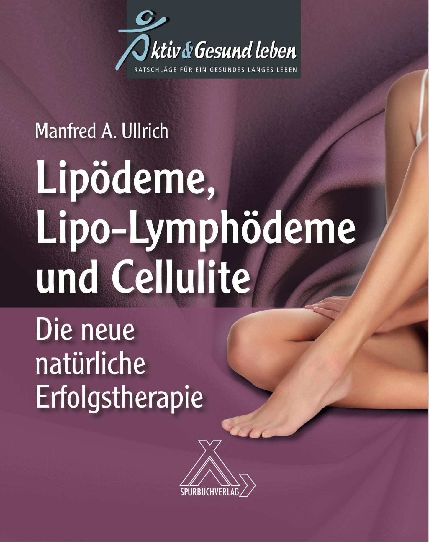 Vorderes Coverbild Lipoödeme, Lipo-Lymphödeme und Cellulite