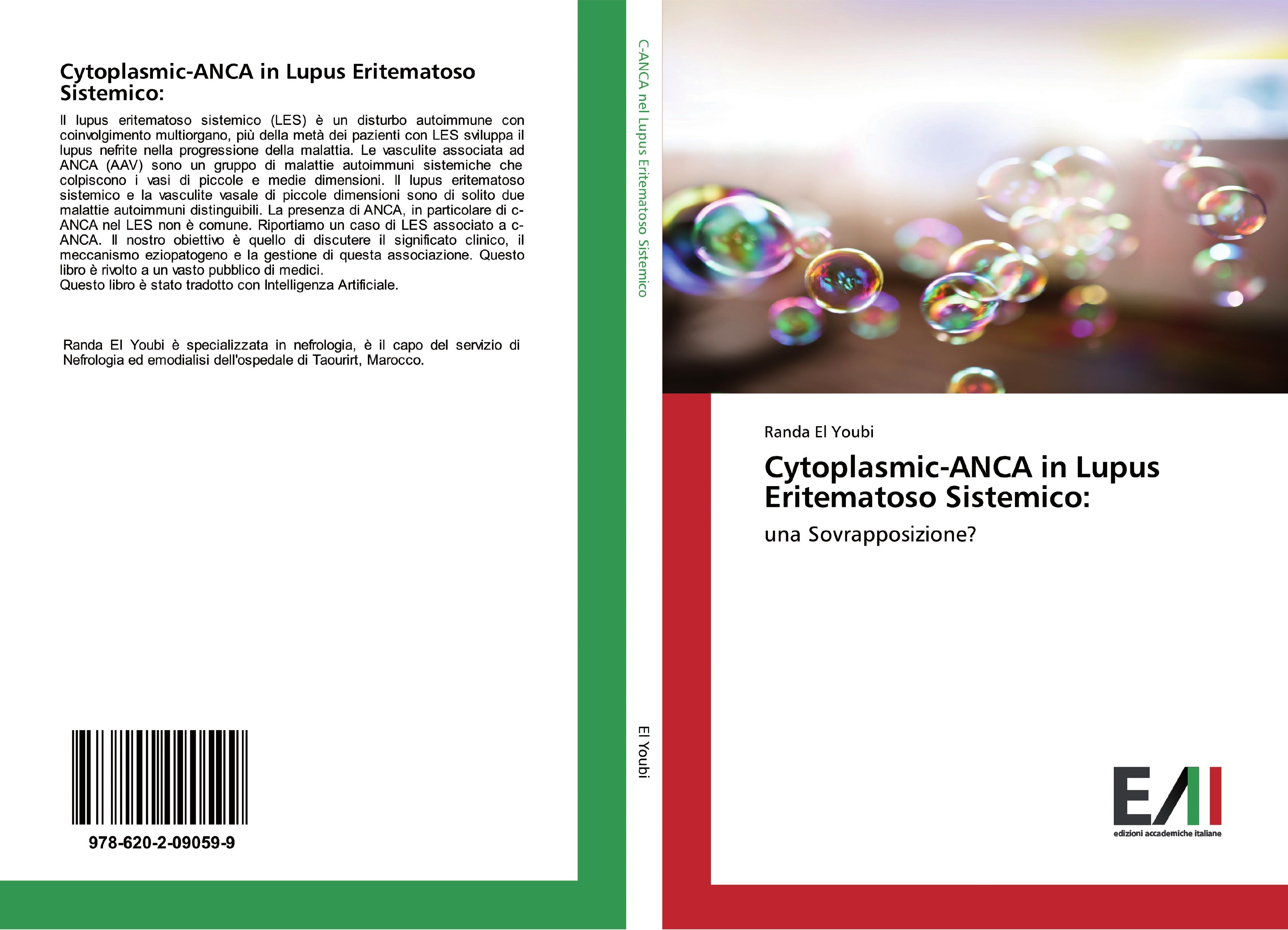 Vorderes Coverbild Cytoplasmic-ANCA in Lupus Eritematoso Sistemico: