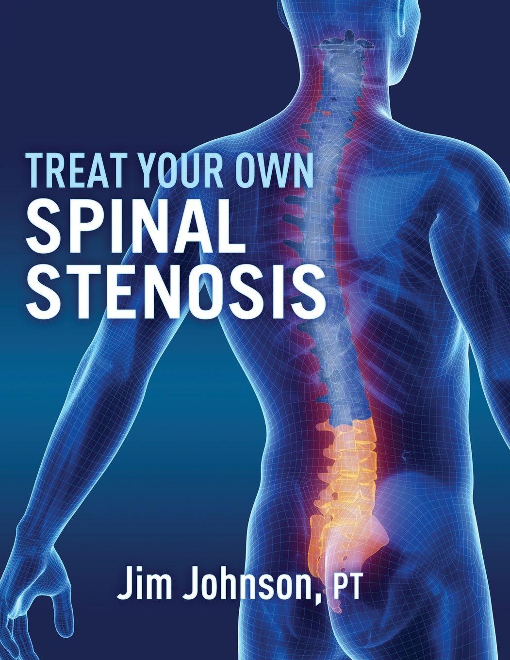 Vorderes Coverbild Treat Your Own Spinal Stenosis