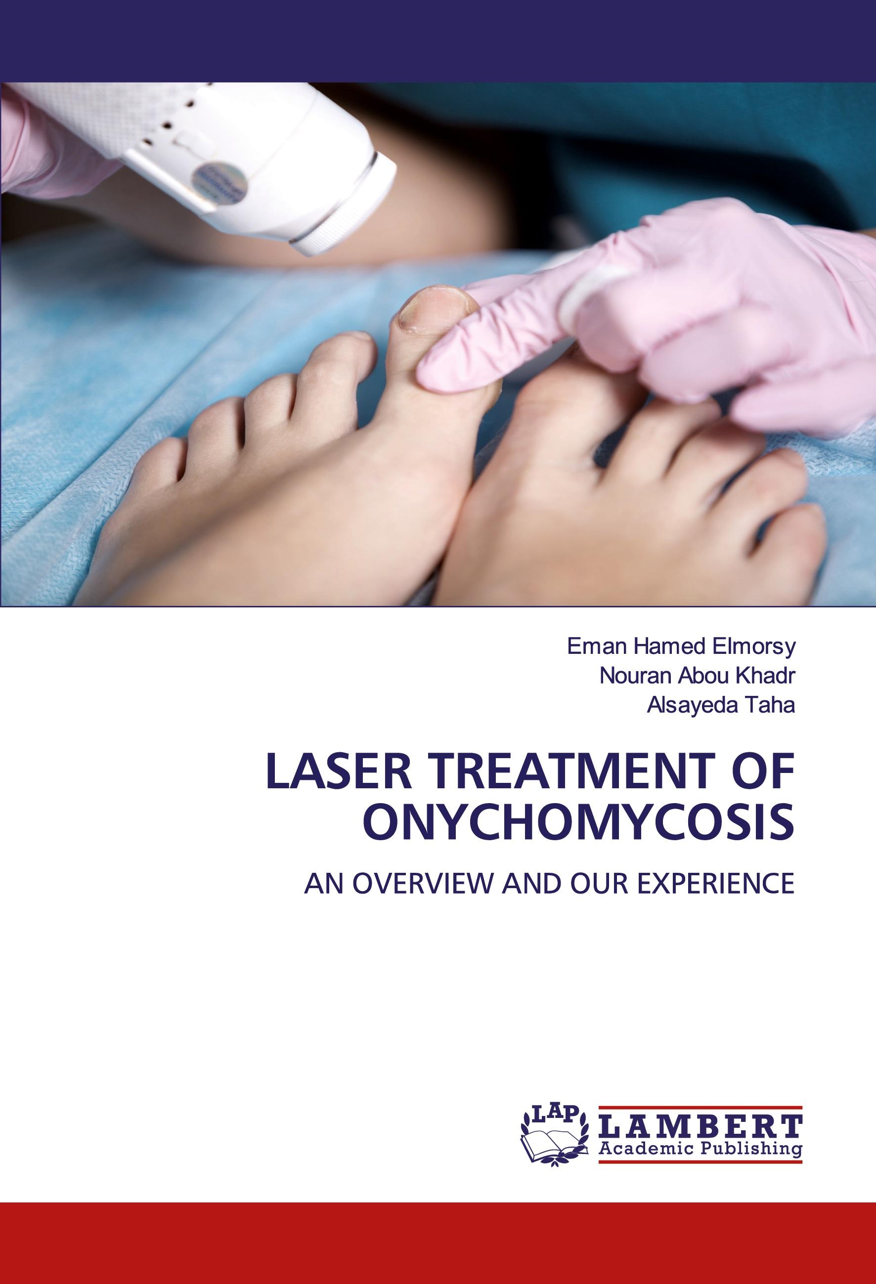 Vorderes Coverbild LASER TREATMENT OF ONYCHOMYCOSIS