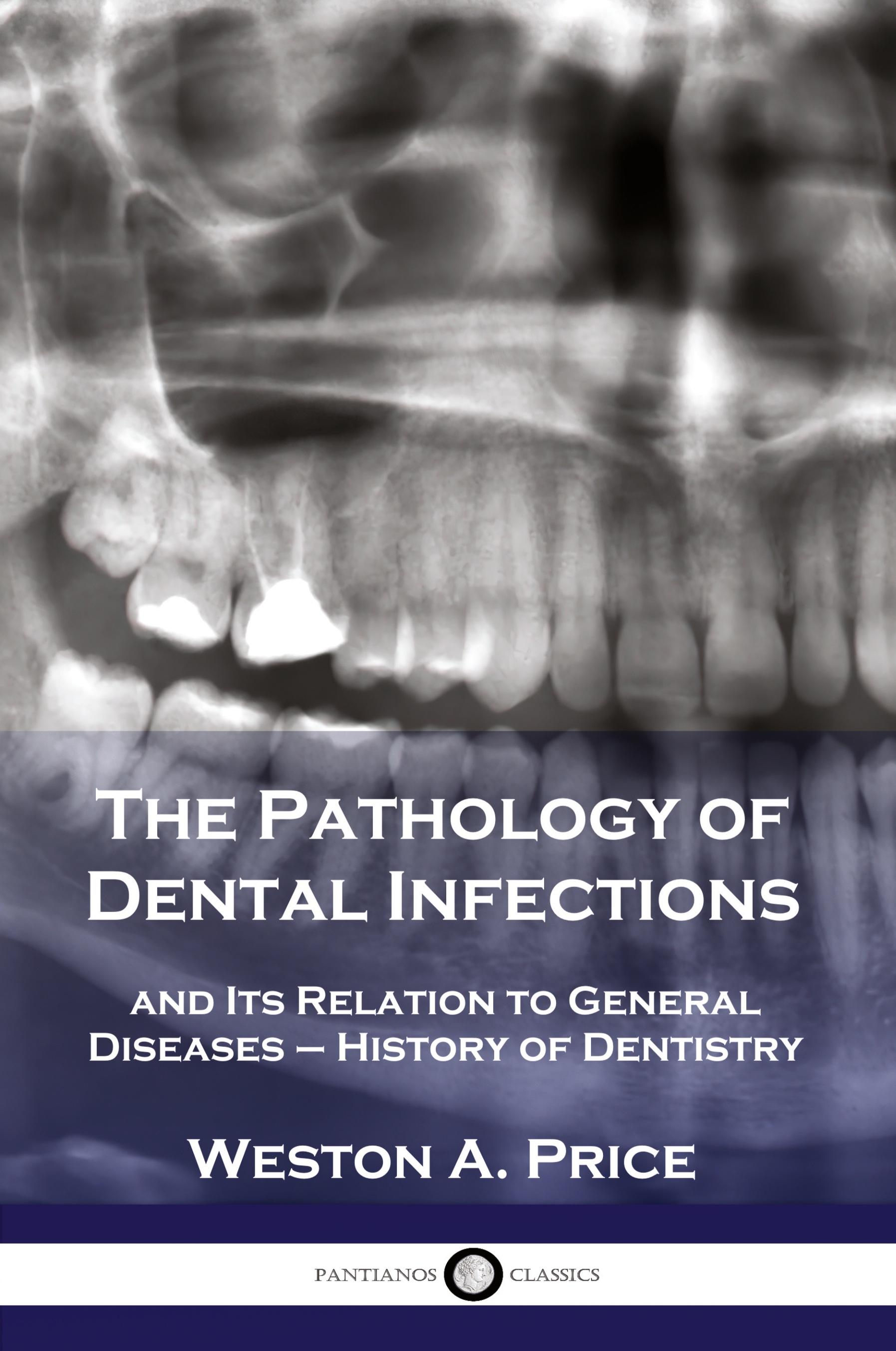Vorderes Coverbild The Pathology of Dental Infections